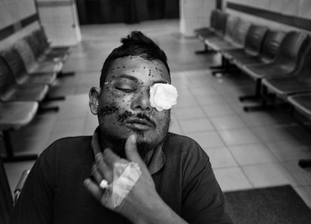 সীমান্তের কাঁটাতারে ঝুলে দরিদ্র বাংলাদেশিদের লাশ